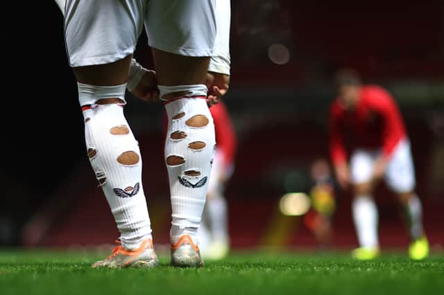 Why Do Soccer Players Have Holes in Their Socks?